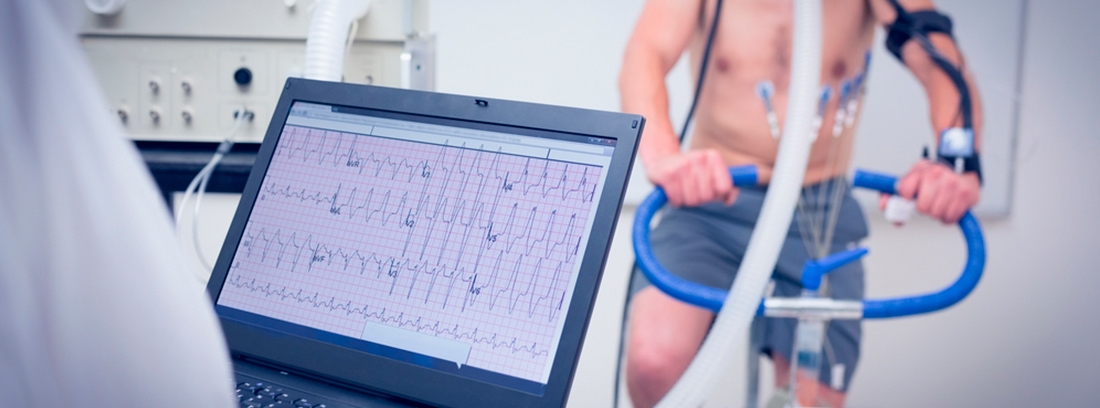 Pruebas Diagnosticas Cardiol Gicas Ergometr A Canalsalud