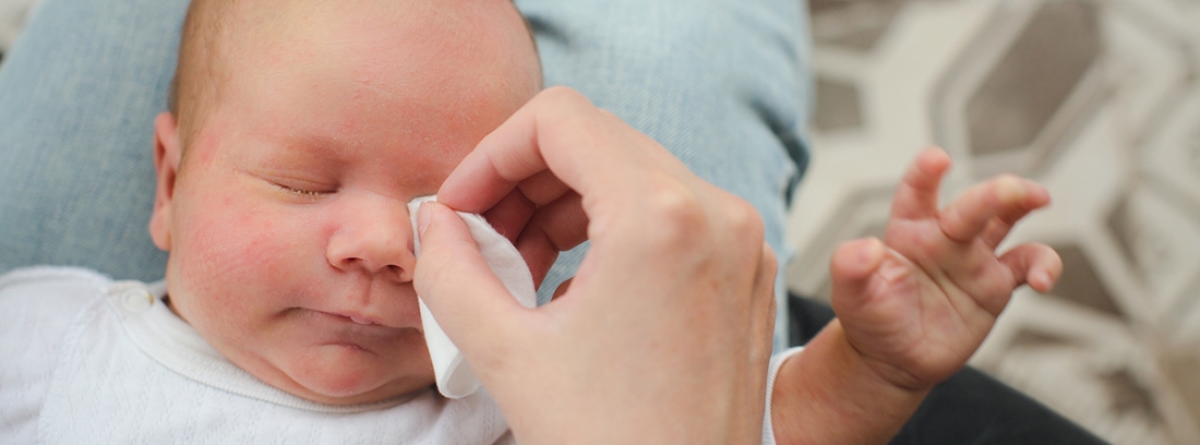 Conjuntivitis En Bebes Recien Nacidos Canalsalud