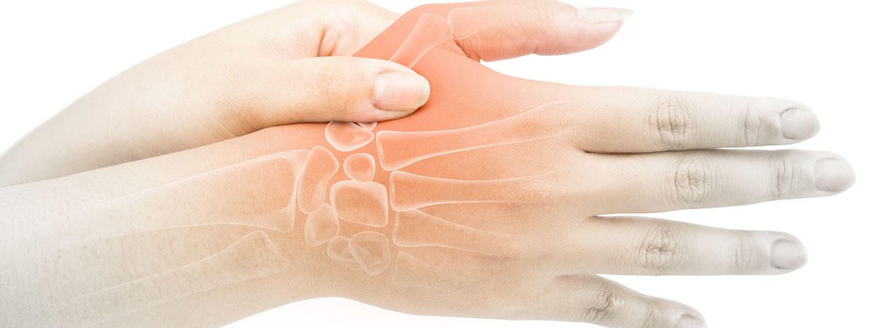 Sufres artrosis en las manos? Sigue estos consejos
