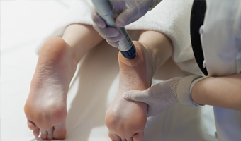 Médico tratando la fascitis plantar de un paciente.