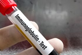 Test IgA ¿qué mide?: tubo de sangre de test de inmunoglobulina