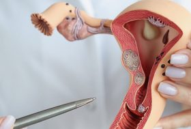 Clotoromegalia: doctor con una maqueta de los organos reproductores femeninos