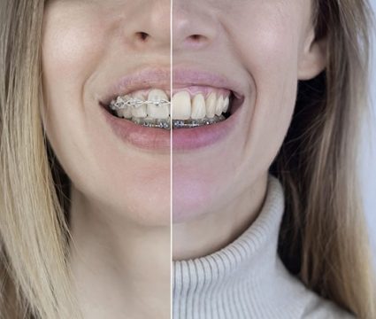 Hilo dental: ¿Antes o después del cepillado?