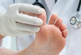 médico examinando la piel de un pie con dermatomicosis