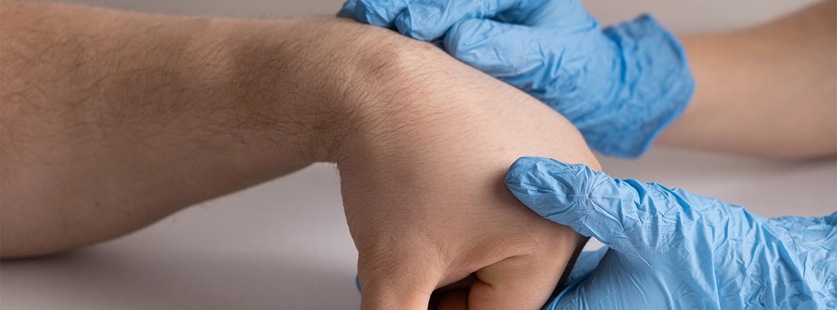 Profesional médico explorando un lipoma en la muñeca de un paciente