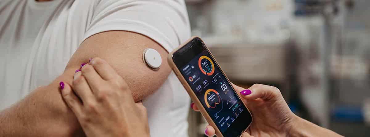 brazo masculina con sensor de diabetes, controlado por un móvil.