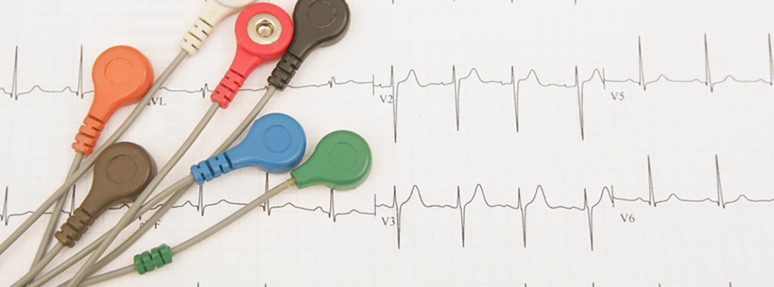 Record Holter Como Se Coloca Un Holter De 24 Horas